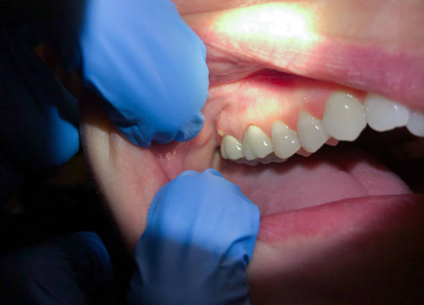 Best After-Hours Dental Trauma Care in Briggs, OK